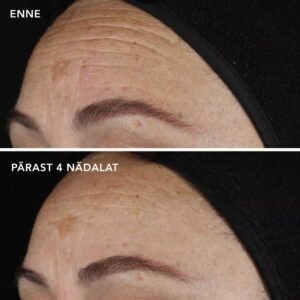 Travel AGELESS+ Retinooliseerum 0,1% 15ml - Pilt 3