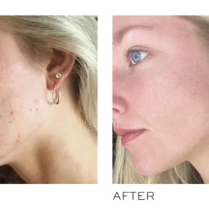 SkinCapsule Clear+ toidulisand probleemsele nahale - Pilt 4