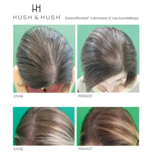 Alternative view of DeeplyRooted® toidulisand juuksekasvu stimuleerimiseks
