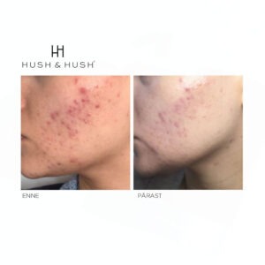 Alternative view of SkinCapsule Clear+ toidulisand probleemsele nahale